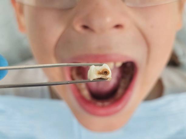 Best Tooth Pain Emergency Relief  in Progreso, TX